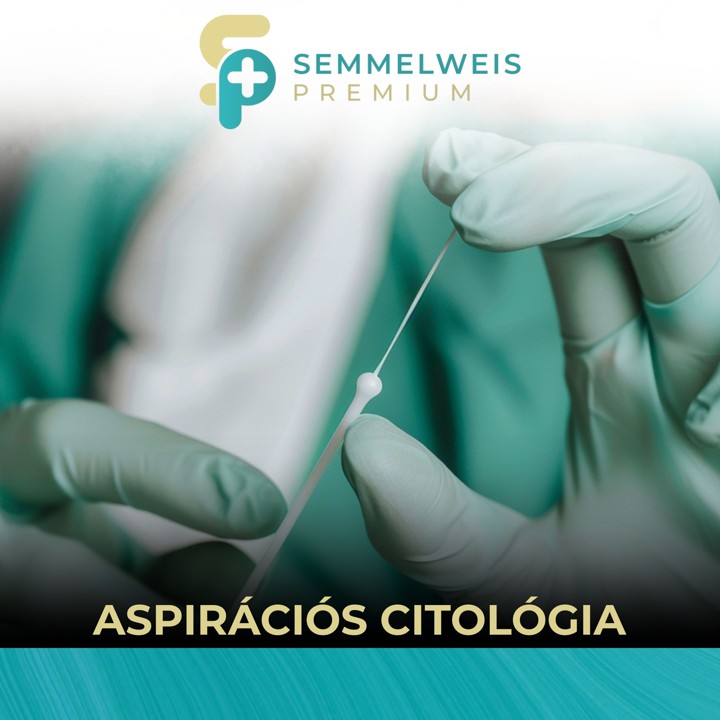 Aspirációs citológia