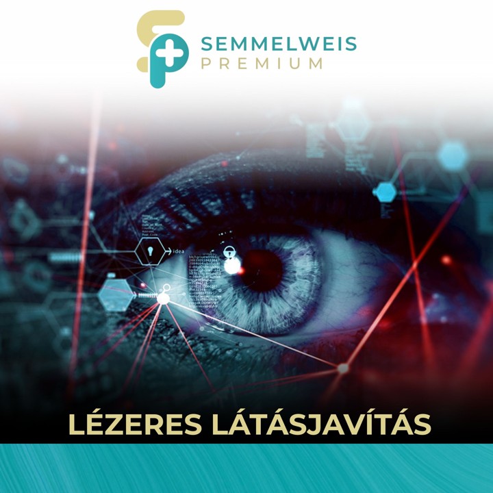 Lézeres látásjavítás