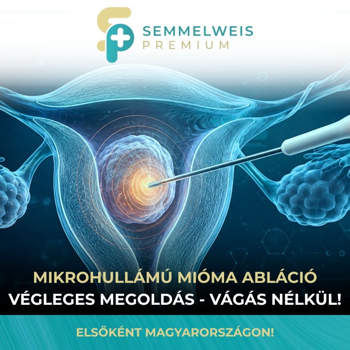 Mikrohullámú Mióma Abláció