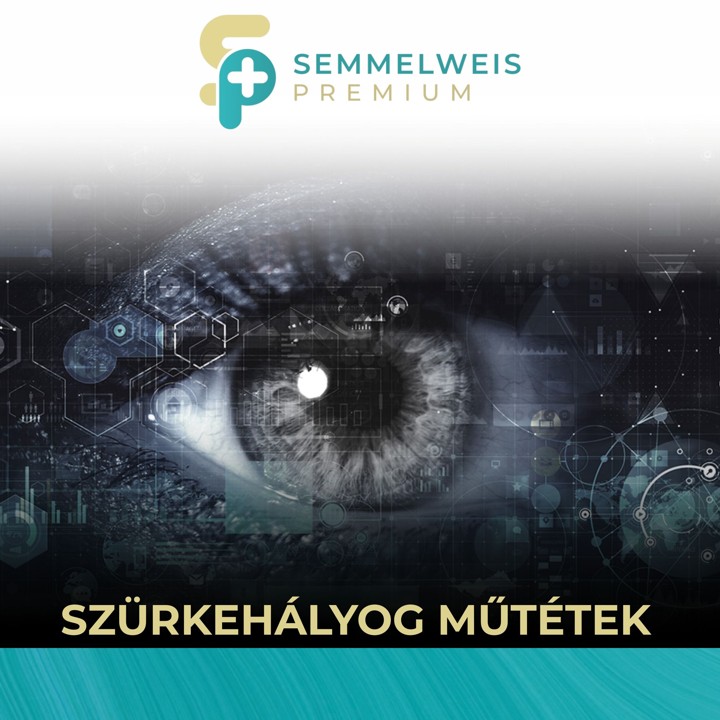 Szürkehályog műtétek